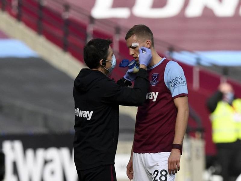 Zraněný fotbalista West Hamu Tomáš Souček se nechává ošetřit.