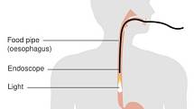 Diagram ukazuje, kudy přes trávicí ústrojí optický přístroj prochází