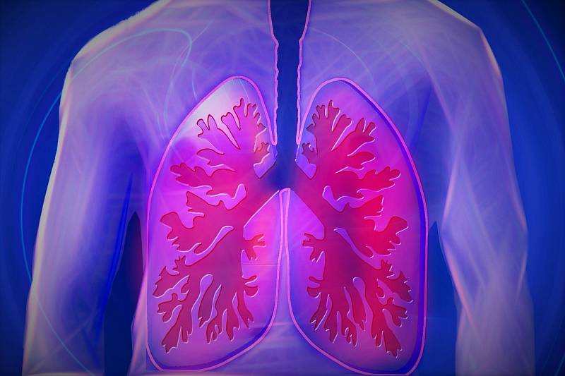 Onemocnění plic - ilustrační foto