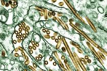 Virus H5N1. Naleznou američtí vědci vakcínu proti současné ptačí chřipce?