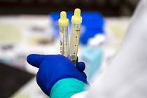 Odebrané vzorky pro testování na koronavirus