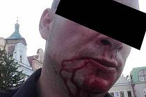Takto dopadl v sobotu ráno muž z Havlíčkova Brodu, který byl napaden skupinkou cizinců v havlíčkobrodské Žižkově ulici.