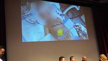 Na tiskové konferenci IKEM ukazovala jak funguje rozšířená realita na operačním sálu.