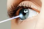 Šedý zákal je porucha průhlednosti oční čočky, která snižuje kvalitu vidění.
