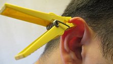 Jednotlivé body na uchu mají schopnost ulevit od bolestí