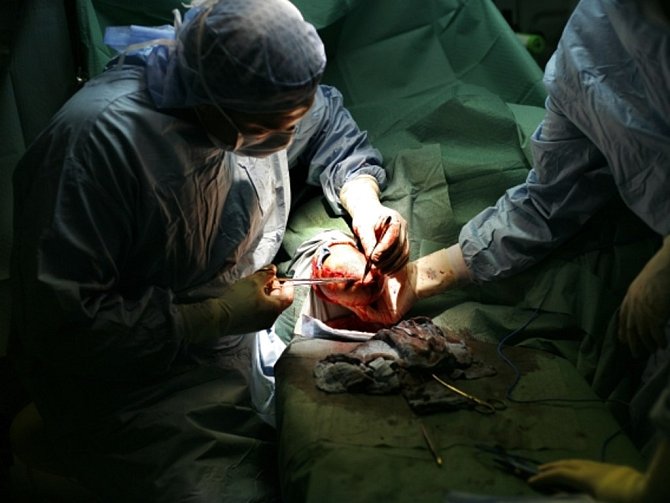 Moderní vědecké postupy potvrzují, že ledviny a další lidské orgány darované k transplantaci se budou zřejmě moci používat vícekrát. 