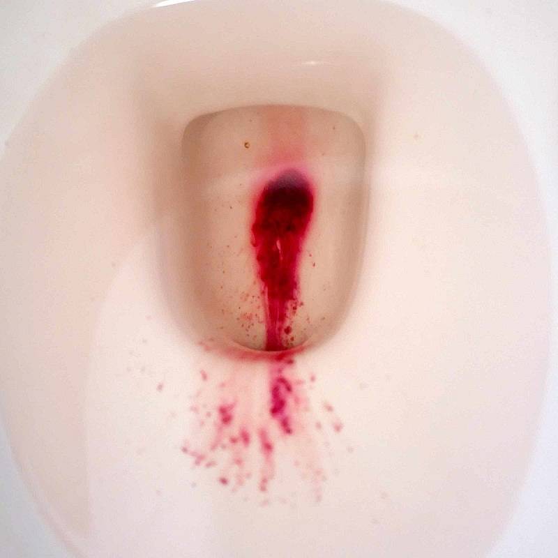 Ženy, které volnou menstruaci ovládnou, jsou schopné otevřít čípek a krev vypustit na toaletě.