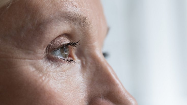 Diabetická retinopatie je onemocnění postihující cévy sítnice v důsledku vysoké hladiny cukru v krvi