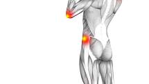 Počátky revmatoidní artritidy se projevují bolestí a otokem kloubů, nejčastěji kolenních a těch u prstů a ruky. Onemocnět ale mohou skoro všechny klouby v těle