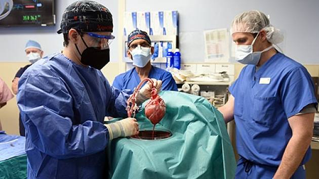 Lékaři z University of Maryland uskutečnili unikátní operaci. Pacientovi transplantovali prasečí srdce. Snímek pochází přímo ze zákroku.