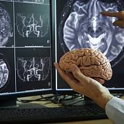 Lidský mozek - Ilustrační foto