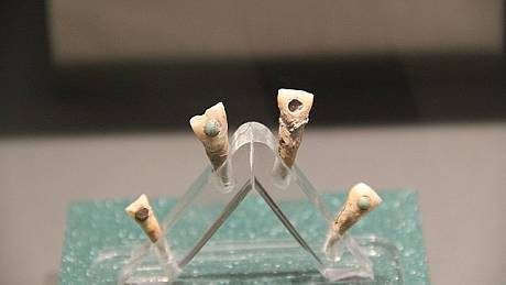 Staří Mayové si nechávali vyvrtávat zuby a vsazovali do nich drahokamy. Intarzie měly pravděpodobně duchovní význam, ale roli hrálo i zdravotní hledisko