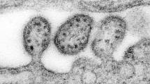 Virus Lassa na záběrech z elektronového mikroskopu