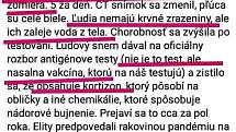 Další hoax, který je "hitem" zejména na slovenských sociálních sítích, ale má přesah také do Česka