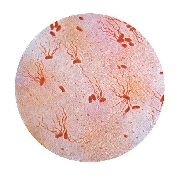 Mikroskopický záběr buňky břišního tyfu