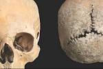 Analýza tisíc sto let staré lebky odhalila dávný zločin