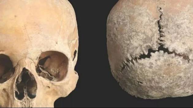 Analýza tisíc sto let staré lebky odhalila dávný zločin