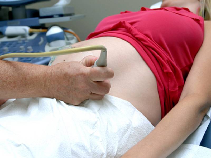 Programové prohlášení má podle Zdravotnického deníku, který na téma upozornil jako první, obsahovat i k speciální bod k reformě porodnictví.