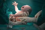 Mezi lékaři, porodními asistentkami i ochránci lidských práv, to vře. Důvod? Česká gynekologická a porodnická společnost (ČGPS ČLS JEP) nedávno schválila nová doporučení pro tzv. komplexní péči o těhotné ženy. 