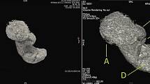 Zobrazení plodu v těle staroegyptské mumie za pomoci výpočetní tomografie (CT)