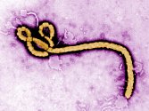 Virus eboly. Ilustrační foto