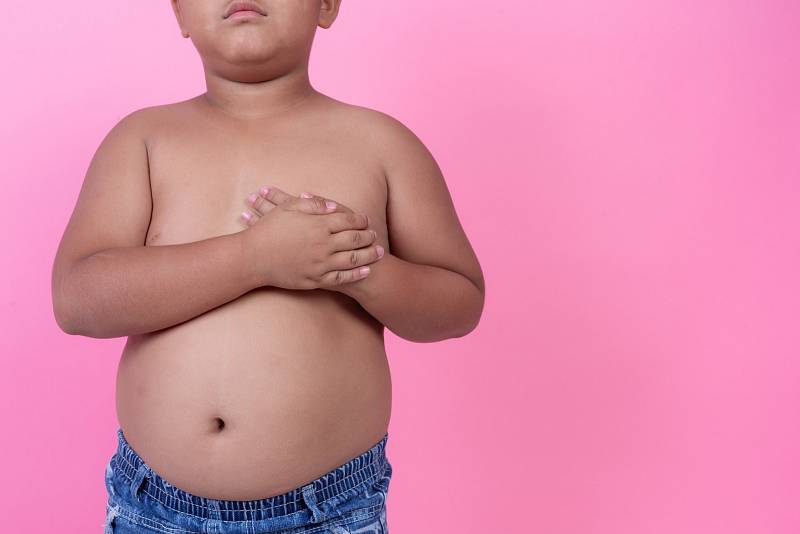 Dětská obezita