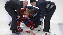 Zkrvavený Lars Eller z Montrealu poté, co ho tvrdě sejmul do hlavy Erik Gryba z Ottawy.