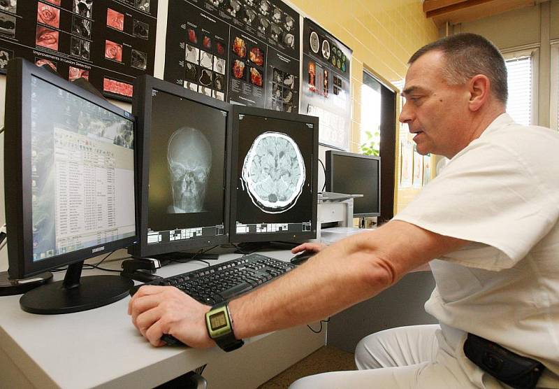 Městská nemocnice v Litoměřicích digitalizuje rentgenologické oddělení. Rentgenové snímky ze snímacího zařízení po zpracování mohou lékaři posílat po vnitřní datové síti na patřičná odělení, kde pacient leží.