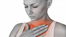 Pálení žáhy se projevuje palčivým pocitem za hrudní kostí a je spojený se stoupáním žaludečních kyselin z žaludku do jícnu a až do dutiny ústní, tzv. refluxem. Vzniká přebytkem šťáv v žaludku, které, pokud jich je normální množství.