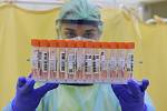 Zdravotnice se vzorky k testování na nákazu koronavirem