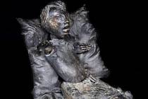 Ve Stolbergu nedaleko Cách byl odhalen pomník obětem Conterganu; jde o bronzovou sochu dítěte s nepřirozeně krátkými pažemi.