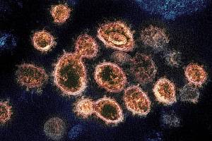 Virus SARS-CoV-2, snímek z transitního elektronového mikroskopu