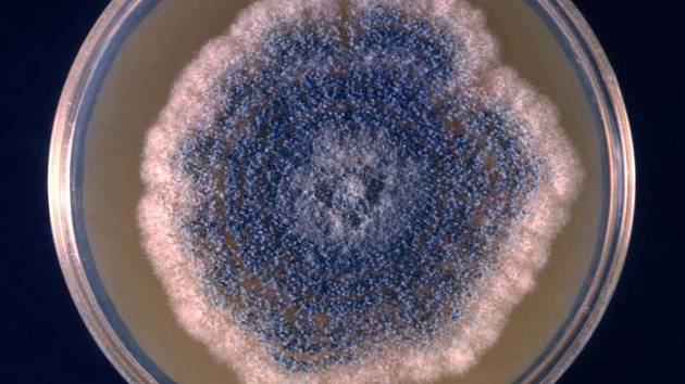 Kolonie houby Aspergillus v Petriho misce