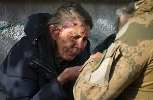 Žena zraněná během ruského raketového útoku na Kyjev, 10. října 2022.