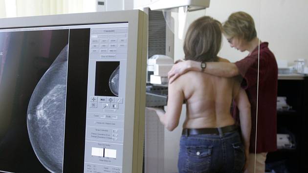 Vyšetření na mamografu. Ilustrační foto.