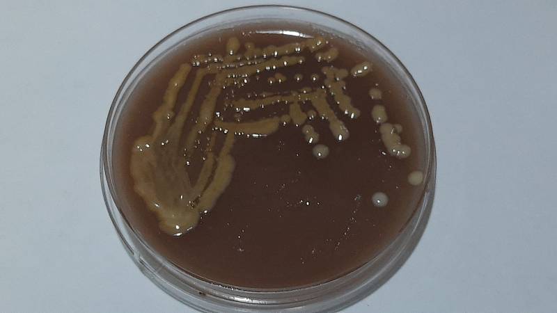 Kolonie kryptokoka v Petriho misce
