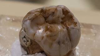 Zub starý 130 tisíc let. Objev v Laosu by mohl poodhalit záhadu denisovanů  - Deník.cz