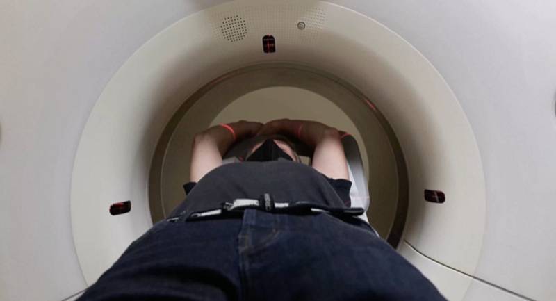 CT vyšetření může ukázat změny na plicích.
