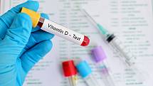 Jestli člověku chybí vitamin D prokáže jednoduchý test z krve.