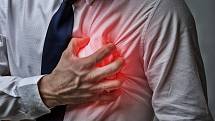 Rizikové faktory infarktu: dlouhotrvající stres, nezdravý životní styl (kouření, obezita a nedostatek pohybu), vysoký krevní tlak, vysoký cholesterol