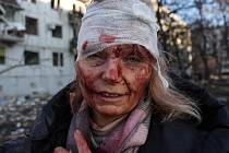 Rusové popírají, že by jejich útoky zasáhly civilní obyvatelstvo. Fotografie z Ukrajiny ale hovoří jinak…