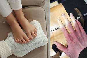 Studené nohy a ruce se nevyplácí podceňovat, mohou být příčinou vážných chorob.