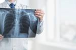 Podle odborníků může až 450 000 jedinců v České republice žít se zatím nediagnostikovanou chronickou obstrukční plicní nemocí.