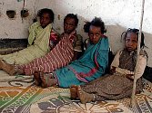 Etiopie: I třetí den po provedené obřízce musejí holčičky z vesnice Harmukaleh sedět se svázanýma nohama. V izolaci dívky zůstanou, dokud se jim rány nezahojí, což může trvat i měsíc.