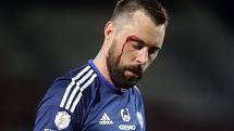 Michal Ordoš z Olomouce si ze zápasu s Baníkem odnesl i krvavé zranění.
