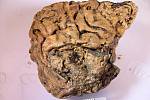 Zachovalá mozková tkáň člověka, který zemřel před 2600 lety