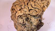 Zachovalá mozková tkáň člověka, který zemřel před 2600 lety