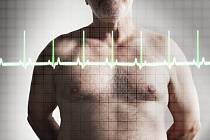 Nárůst kardiovaskulárních chorob je velkým břemenem  i pro zdravotní systémy.