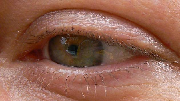 Nejběžnější barvou oka je hnědá.