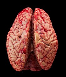 Mozek in natura - pohled zeshora